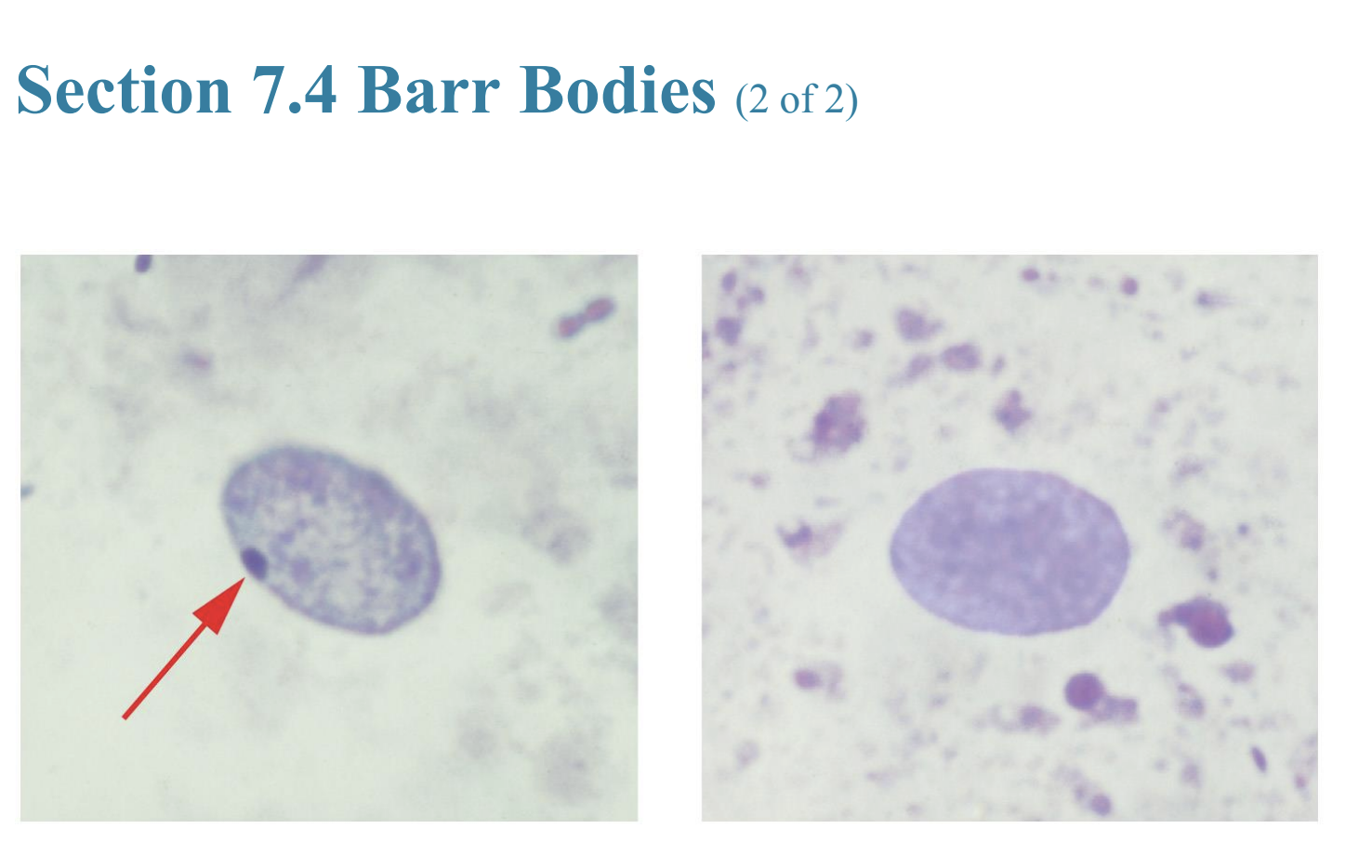 <ul><li><p>Barr bodies (sex chromatin bodies)</p></li><li><p>Barr bodies</p></li></ul><p></p>