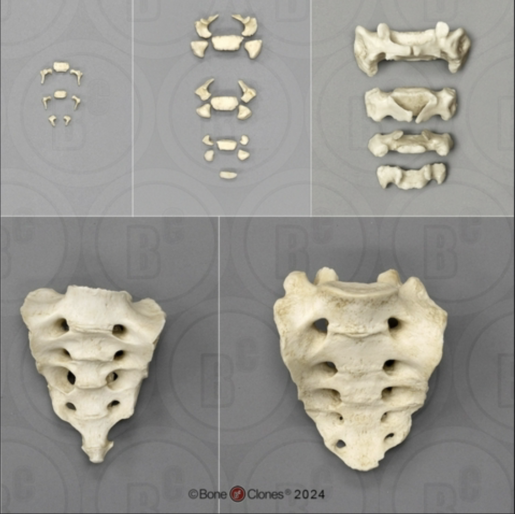 <p>What bone is thie?</p>
