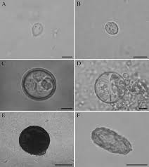 <ul><li><p>found in formed stool</p></li><li><p><strong>rigid, non-motile, infectious</strong></p></li><li><p>resistant to environmental changes</p></li><li><p>found in asymptomatic hosts or carriers</p></li></ul><p></p>