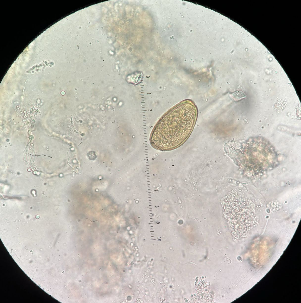 <p>Kingdom?</p><p class="p1">Phylum?</p><p class="p1">Class?</p><p class="p1">Order?</p><p class="p1">Family?</p><p class="p1">Species/Stage?</p>