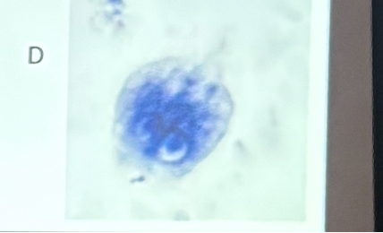 <p>What is this organism?</p>