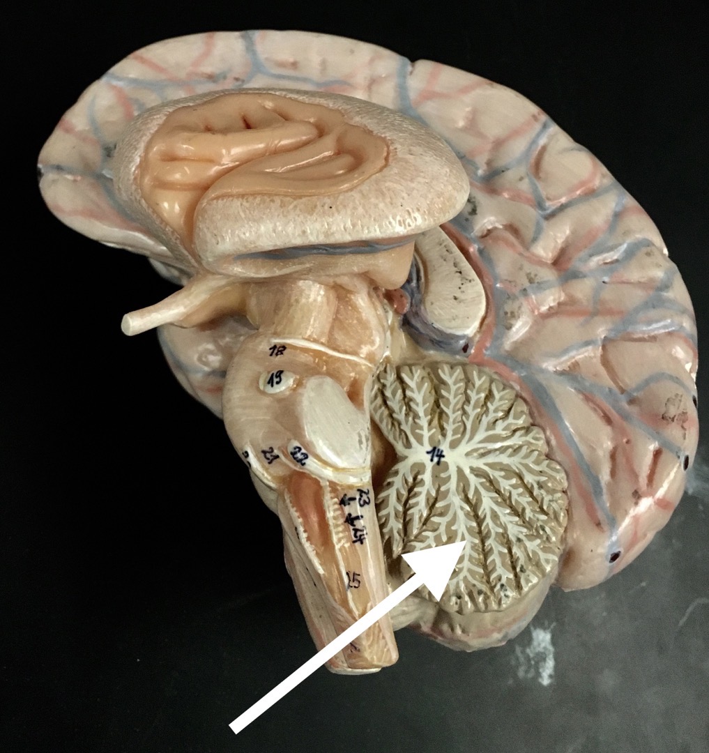 <p>What is the white structure the arrow is pointing to?</p>