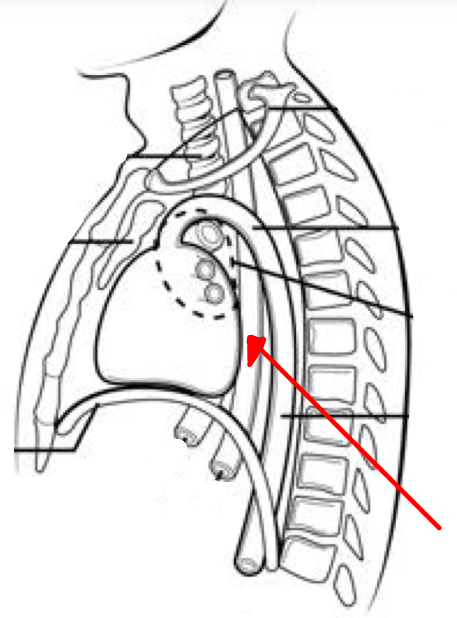<p>Identify the organ the red arrow it pointing to.</p>