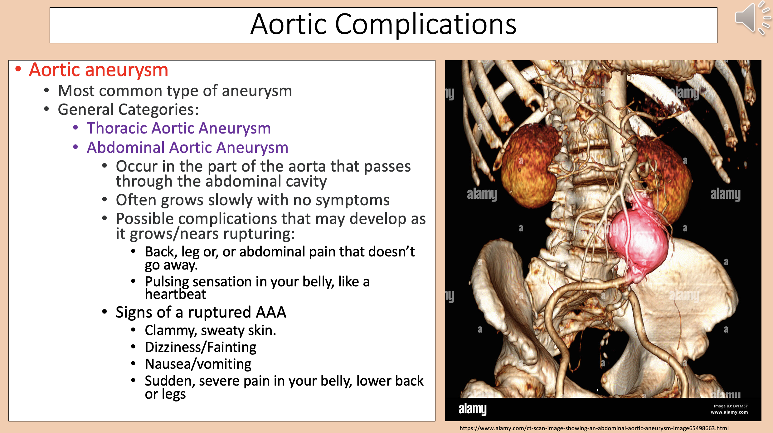 <p><span style="color: rgb(112, 48, 160);">abdominal aortic aneurysm </span><span style="color: rgb(52, 53, 54);">complications</span></p>