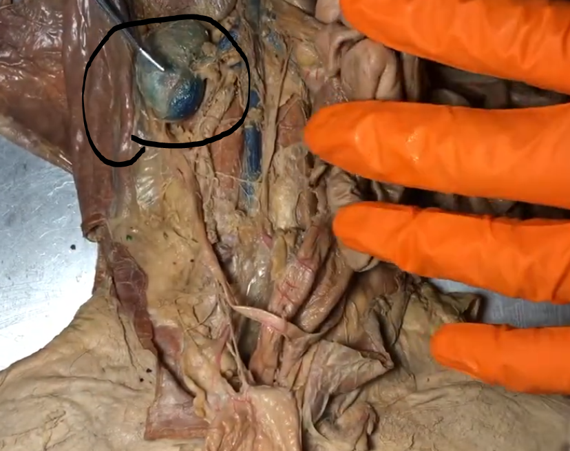 <p>What sits on top of the kidney circled</p>