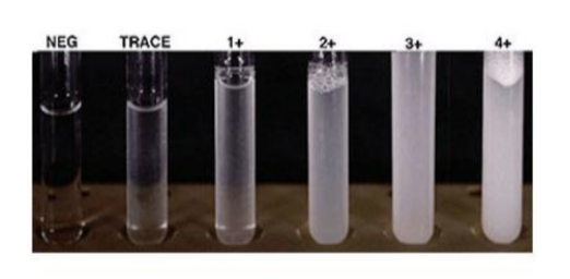 <ul><li><p>confirmatory test for proteins in urine</p></li><li><p>3% sulfosalicylic acid = detects albumin, globulins, bence-jones proteins</p></li><li><p>added to small and equal volume of urine</p></li><li><p>acidification causes precipitation of proteins in urine</p></li><li><p>semi-quantitated visually or more precisely using photometry </p></li></ul><p></p>