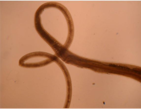 <p>What is the kingdom, phylum, order, and family of this parasite</p>