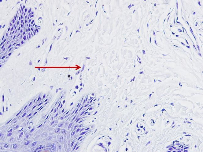 <p>Tế bào gì ?</p>