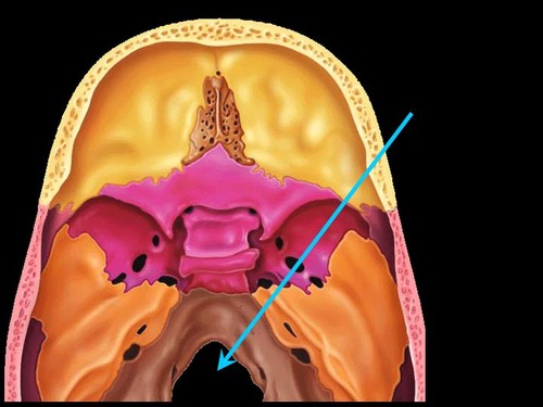 <p>Name the contents of foramen magnum</p>