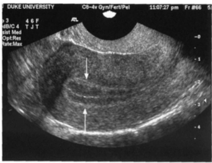 <p>Identify the endometrial phase</p>