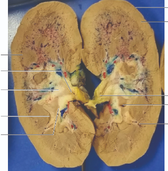 <p>label bank</p><p></p><p>major calyx</p><p>renal column</p><p>minor calyx</p><p>renal papilla</p><p>renal capsule</p><p>renal pelvis</p><p>renal cortex</p><p>renal sinus adipose</p><p>ureter</p>