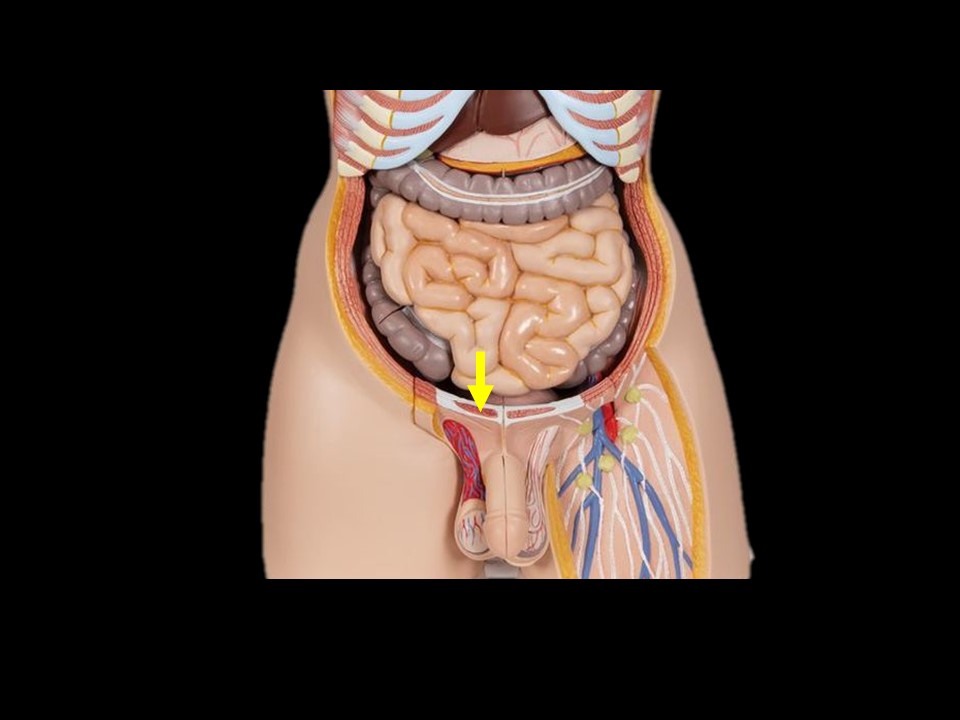 <p>Name the muscle </p>