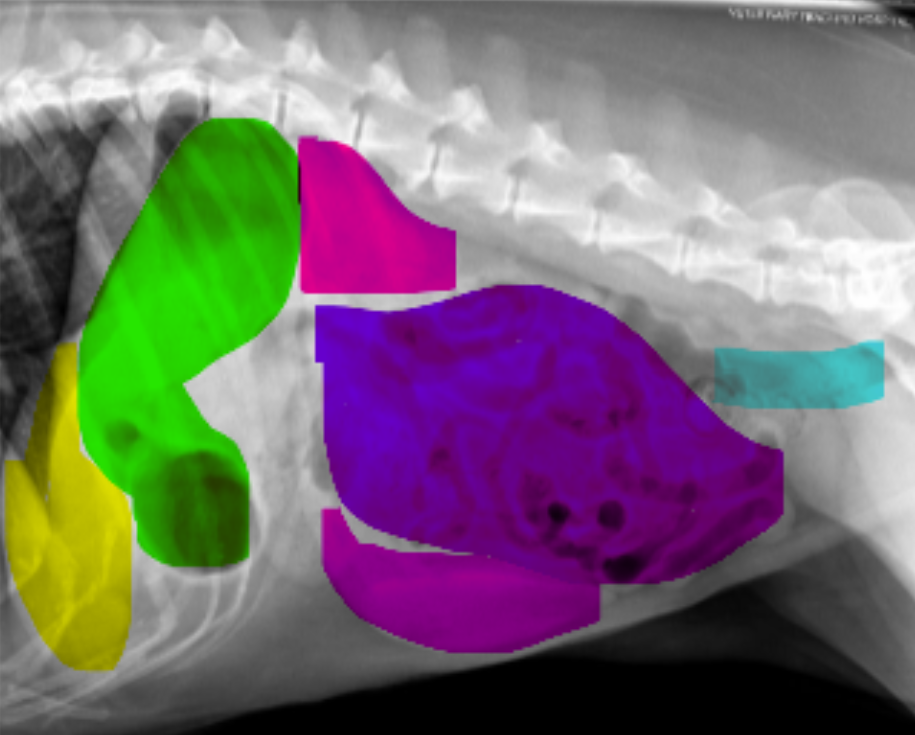 <p>What organ is highlighted blue?</p>