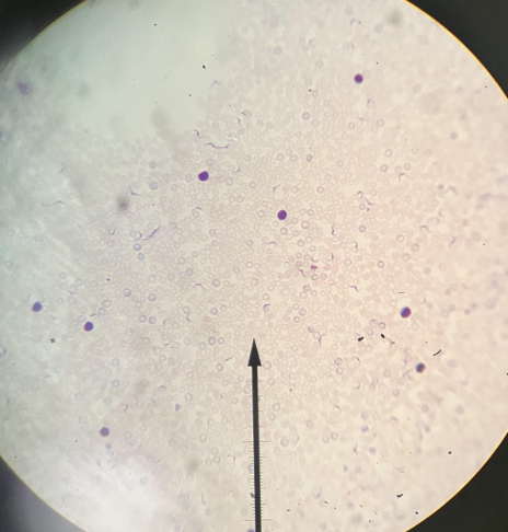 <p>associated disease</p>