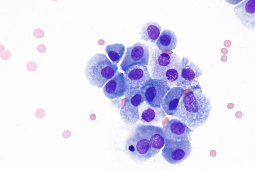<p>Attack cells that are found in connective tissue; very dark center with lighter surrounding bubbly body (from lysosomes)</p>