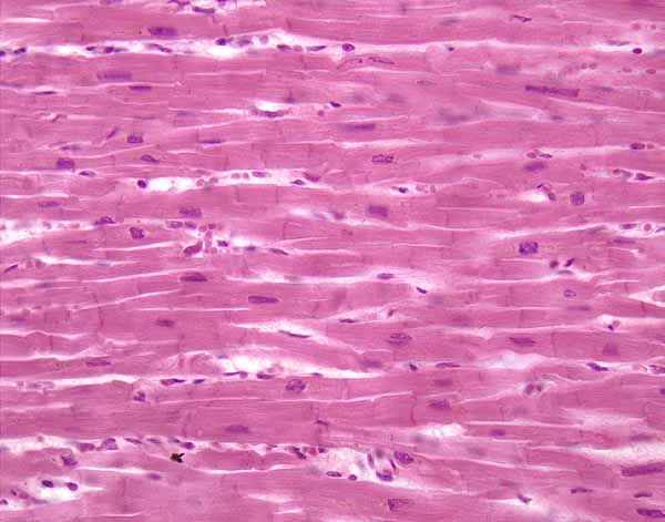 <p>cardiac muscle tissue</p>