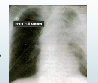 <p>White stuff this is actualy stuff that shows up</p><p>Black is air </p>