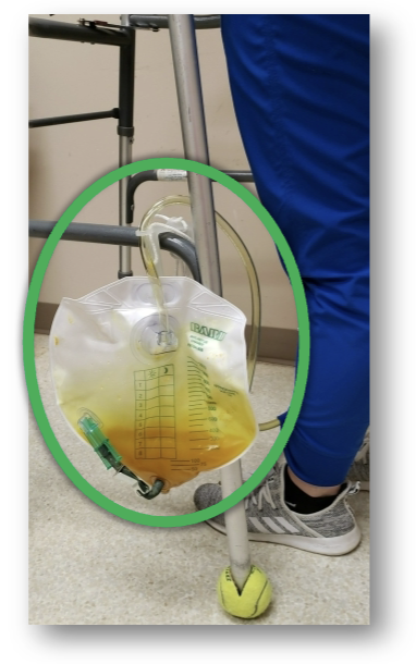 <p>Foley Care Considerations</p>