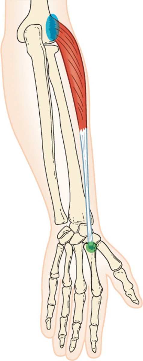 <p>O: lateral supracondylar ridge of humerus</p><p>I: base of 2nd metacarpal</p><p>A: wrist extension, radial deviation</p><p>N: radial nerve</p>