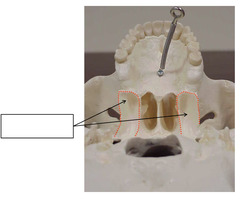 <p>Inferior-Posterior View of Skull</p>