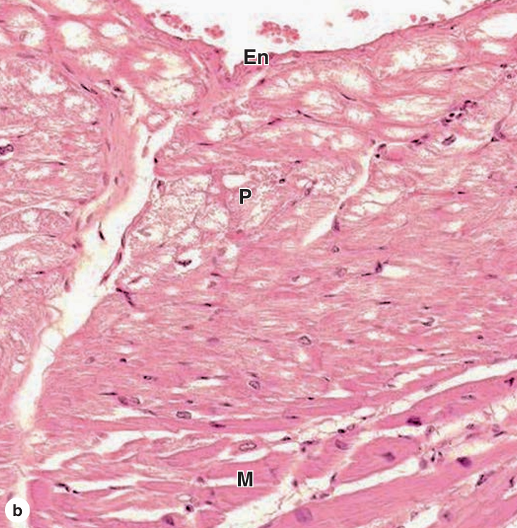 <p>P</p>