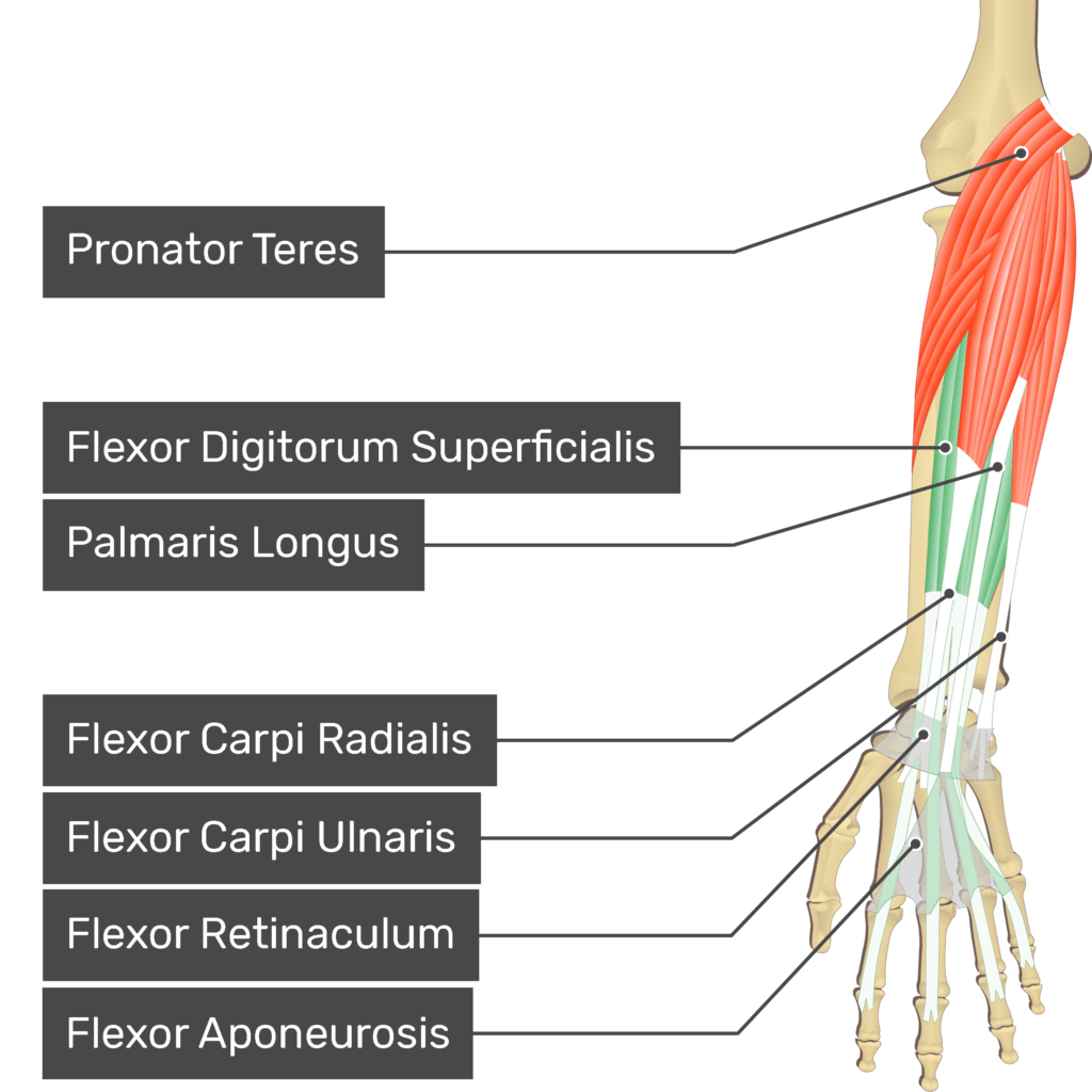 <p>medial epicondyle=common flexor origin</p><p>innervated by median nerve EXCEPT for flexor carpi ulnaris and medial ½ of flexor digitorum profundus </p><p>flex the wrist and fingers and some of them pronate </p><p><strong>P</strong>ass (pronator teres)</p><p><strong>F</strong>ail (flexor carpi radialis)</p><p><strong>P</strong>ass (palmar longus)</p><p><strong>F</strong>ail (flexor carpi ulnaris) </p><ul><li><p>lateral —> medial</p></li></ul><p></p><p></p><p><strong>superficial layer</strong></p><p>pronator teres(divides medial (anterior muscles) and lateral(posterior muscles))</p><ul><li><p>origin- medial epicondyle of humerus, coronoid process of ulna</p></li><li><p>insertion- lateral side of middle of radius</p></li><li><p>main action- pronation of forearm, flexion of forearm</p></li></ul><p>flexor carpi radialis (lateral; index side)</p><ul><li><p>origin- medial epicondyle of humerus</p></li><li><p>insertion- 2nd metacarpal(index finger)</p></li><li><p>main action- flexion of hand, ABduction of hand</p></li></ul><p>palmaris longus(palm, long tendon, visible in forearm when putting thumb + pinky together)</p><ul><li><p>origin- medial epicondyle of humerus</p></li><li><p>insertion- palmar aponeurosis(central part of the deep fascia of the palm)</p></li><li><p>main action- flexion of hand, tightening of flexor aponeurosis</p></li></ul><p>flexor carpi ulnaris(medial, innervated by ULNAR nerve)</p><ul><li><p>origin- medial epicondyle of humerus </p></li><li><p>insertion- pisiform, hamate, 5th metacarpal(pinky)</p></li><li><p>main action- flexion of hand, ADduction of hand </p></li></ul><p></p><p><strong>middle layer</strong></p><p>flexor digitorum superficialis(4 tendons; splits and inserts on middle phalanx) </p><ul><li><p>origin- medial epicondyle of humerus</p></li><li><p>insertion- middle phalanx of digits 2-5</p></li><li><p>main actions- flexion of PIP joints(proximal interphalangeal), flexion of MCP(metacarpophalangeal) </p></li></ul><p></p>
