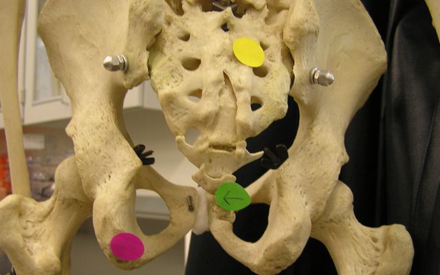 <p><span>Identify the bone indicated by the yellow dot.</span></p>