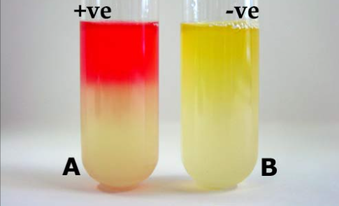<p>Which one is a positive methyl red test and which one is negative?</p>