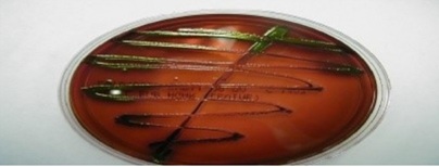 <p>An organism growing on this urine plate is:</p>