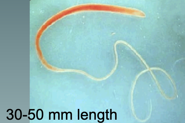 <p>The infective stage is the embryonated egg in soil. transmitted by ingestion of embryonated eggs from contaminated soil, food, or water, or hands. found in tropical and subtropical areas worldwide. sympt: a light infection is less than 100 tapeworms. heavy infection is more than that adn leads to TDS(bloody diarrhea, constant urge to defacate-tenesmus,and rectal prolapse)</p>