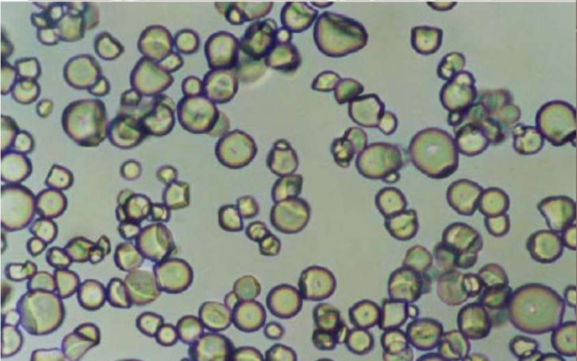 <p>Identify the following starch granules</p>