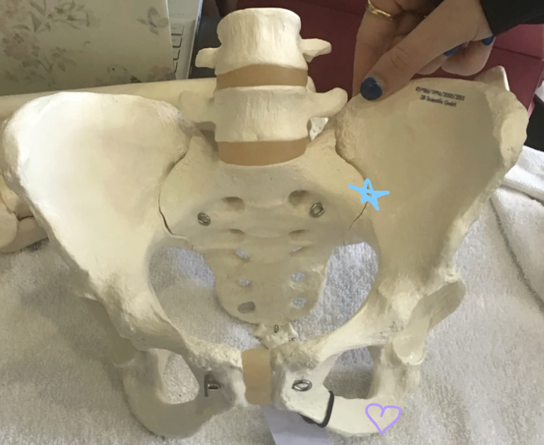 <p>Blue star: What is this structure? What type of joint is this and what is the primary function of this joint?</p><p>Purple heart: What is this structure? What muscles originate here and what actions do they perform?</p>