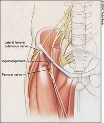 <p>extension</p>