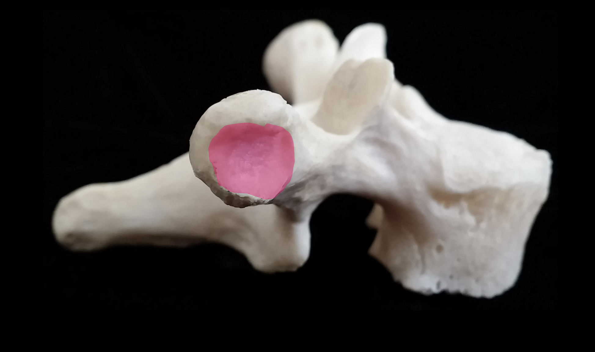 <p>From the lateral view, what is the pink region highlighted on the thoracic vertebrae?</p>