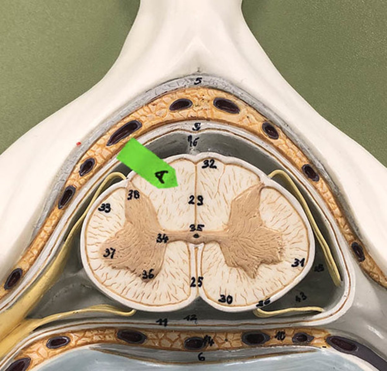 <p>Identify the general name for this light colored nervous tissue.</p>