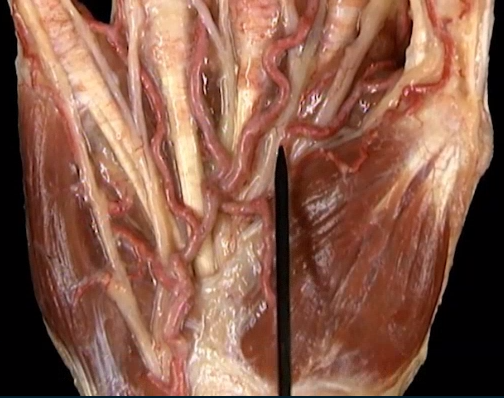 <p>Oppervlakkig, handpalm</p>