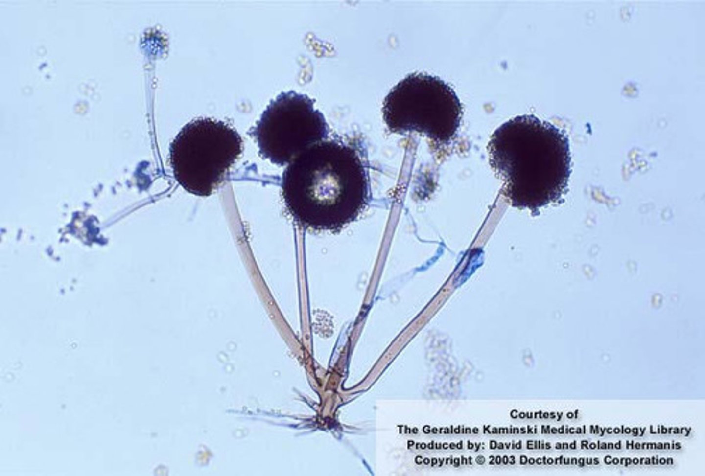 <p>Spherical sporangia</p><p>Coarse rhizoids, spiked</p>