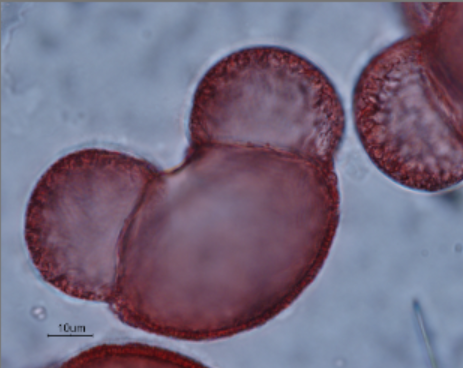 <p>Identify the pollen grains to the <strong>Family</strong> and <strong>Genus</strong></p>