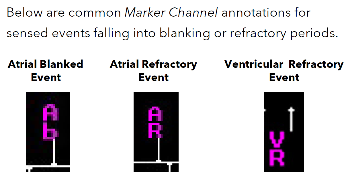 <p>prevent inappropriately sensed signals (such as far-field R-waves, electrical noise, or retrograde conduction) from triggering certain pacemaker timing intervals</p>