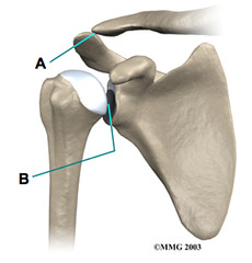 <p>Name Joint B</p>