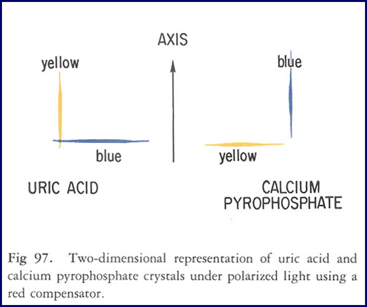 <ul><li><p>1-20μm, needle-like</p></li><li><p>Yellow when parallel to the slow component of the compensator (<strong>negative birefringence</strong>)</p></li></ul><p></p>