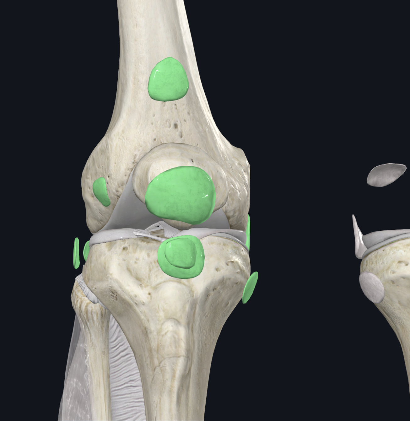 <p>12 or more bursae surround the knee. Subcutaneous bursae: prepatellar, infrapatellar. Bursae in the synovial cavity: suprapatellar. Other bursae: popliteal, pes anserine, gastrocnemius.</p>