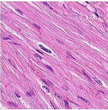 <p>Cardiac Muscle</p>