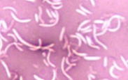 <p>What type of staining?</p>