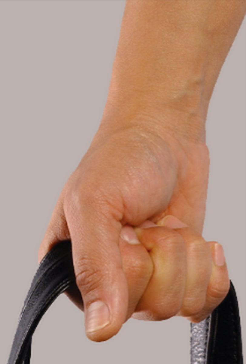 <p>technique in which the litter/backboard is gripped by inserting each hand under the handle with the palm facing up and the thumb fully extended fully supporting the underside of the handle on the curved palm with the fingers and thumb</p>