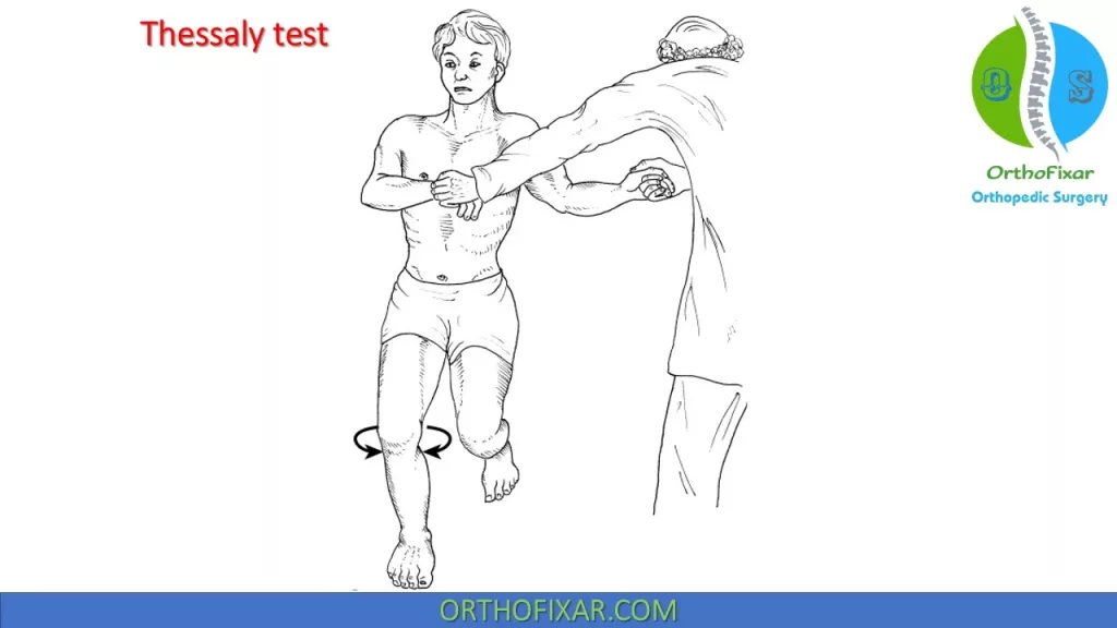 <p>positive test: joint-line discomfort, complaints of “locking” or “catching”</p><p>implications: lesion of medial or lateral meniscus, depending on source of pain and/or catching sensation</p>