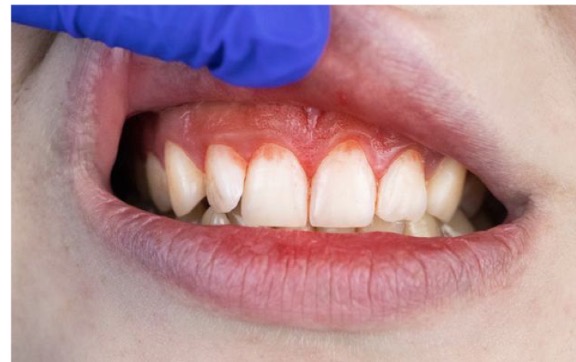 <p>CHẨN ĐOÁN?</p>