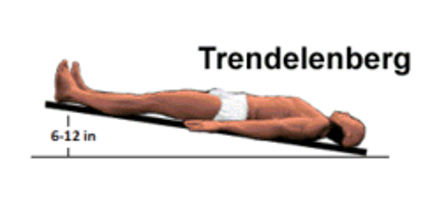 <p>the patient is supine with head of the bed lower than the foot of the bed</p>