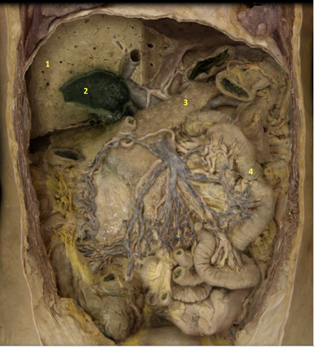 <p>Abdomen - Deep Dissection</p><p>1. Liver</p><p>2. Gallbladder</p><p>3. Pancreas</p><p>4. Small intestine</p>