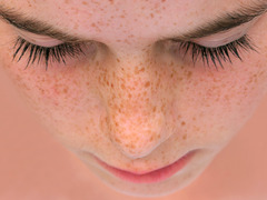 <p>The Freckles</p>